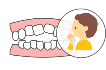 小児の矯正治療
